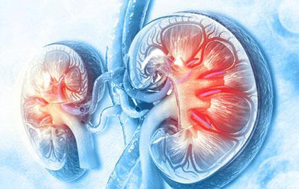 graphic of kidneys